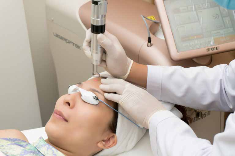 Phương pháp laser có thể điều trị tình trạng mụn bọc nặng một cách tận gốc