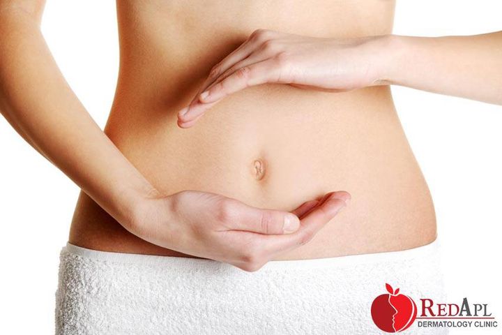 Giảm béo bụng da liễu táo đỏ 