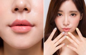 phẫu thuật môi trái tim bao lâu thì lành
