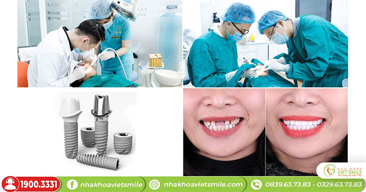 Nha khoa vietsmile 2