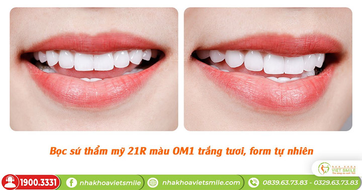Nha khoa việt Smile 3 hà nội 