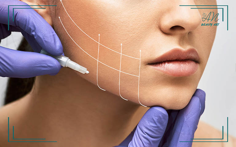 Dịch vụ căng chỉ collagen tại An Beauty Art